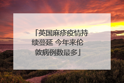 英国麻疹疫情持续蔓延 今年来伦敦病例数最多